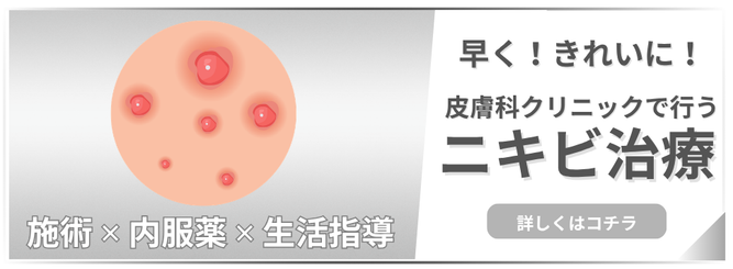 ニキビ治療